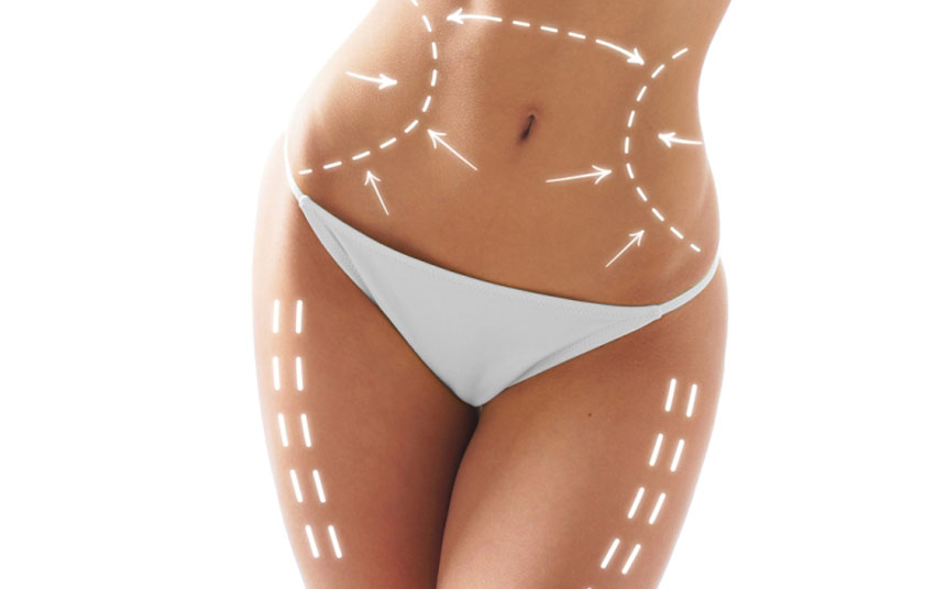 Liposuction