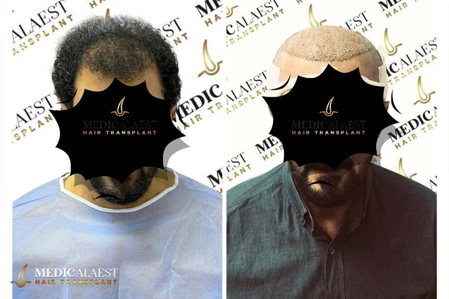 Medicalaest - BEFORE & AFTER GALLERY