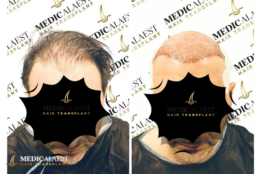 Medicalaest - BEFORE & AFTER GALLERY