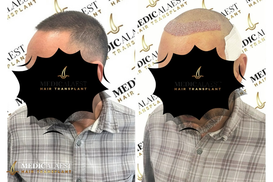 Medicalaest - BEFORE & AFTER GALLERY