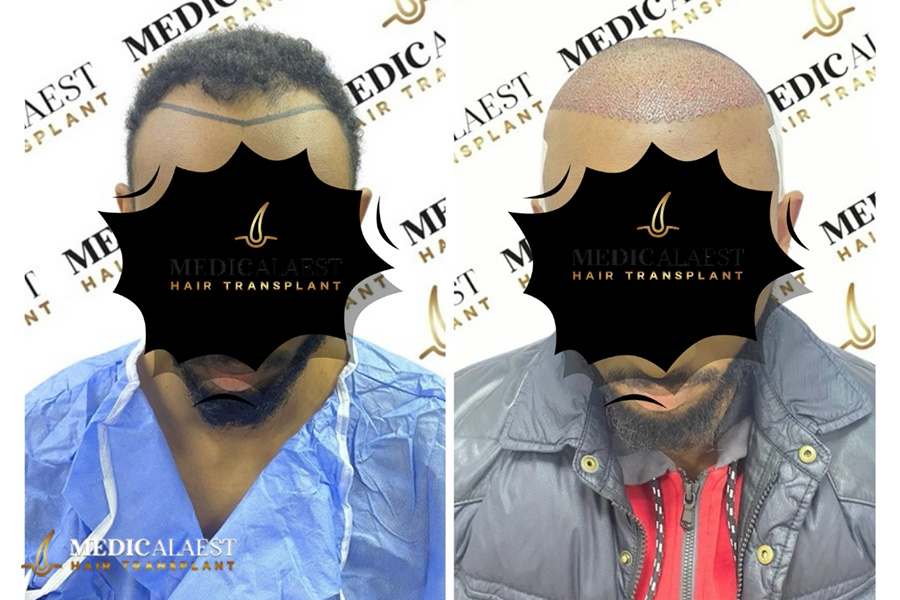 Medicalaest - BEFORE & AFTER GALLERY