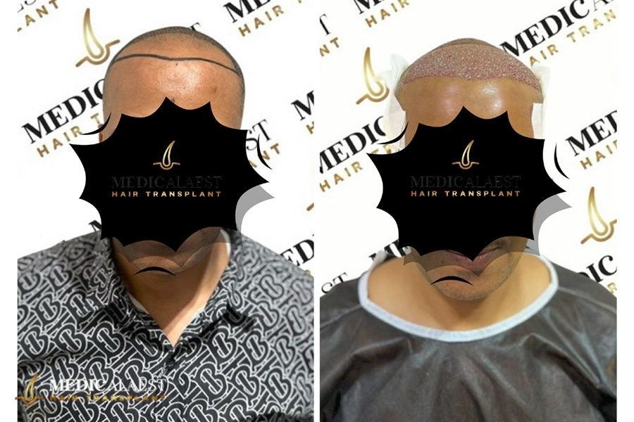 Medicalaest - BEFORE & AFTER GALLERY