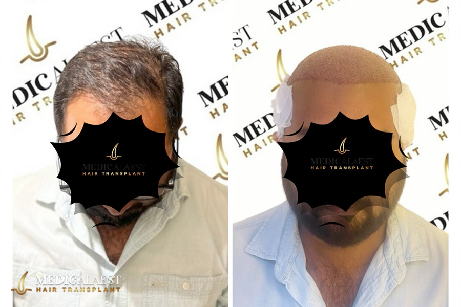 Medicalaest - BEFORE & AFTER GALLERY