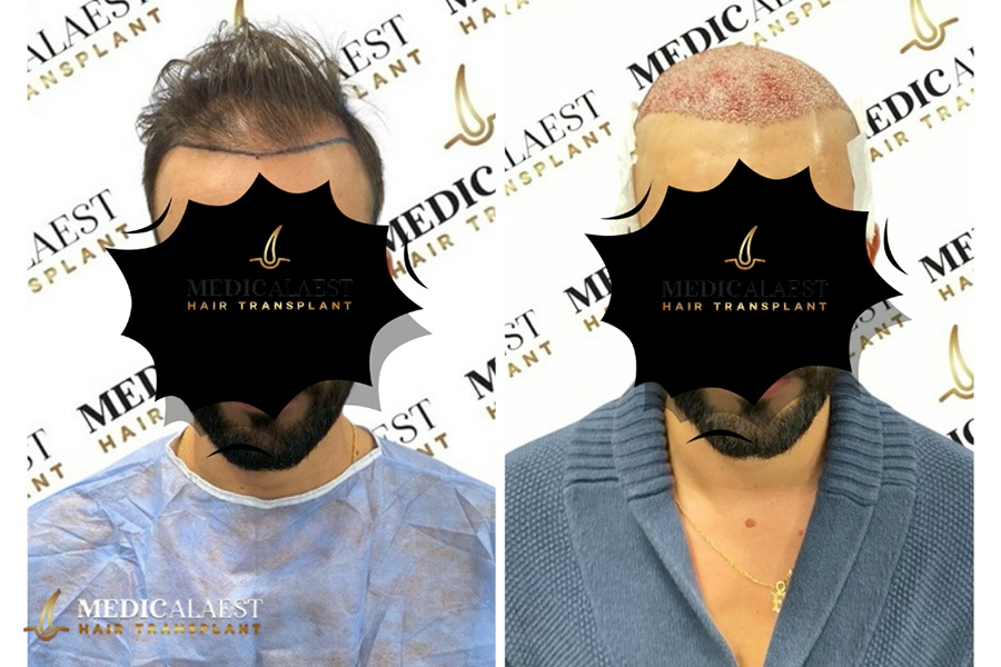 Medicalaest - BEFORE & AFTER GALLERY