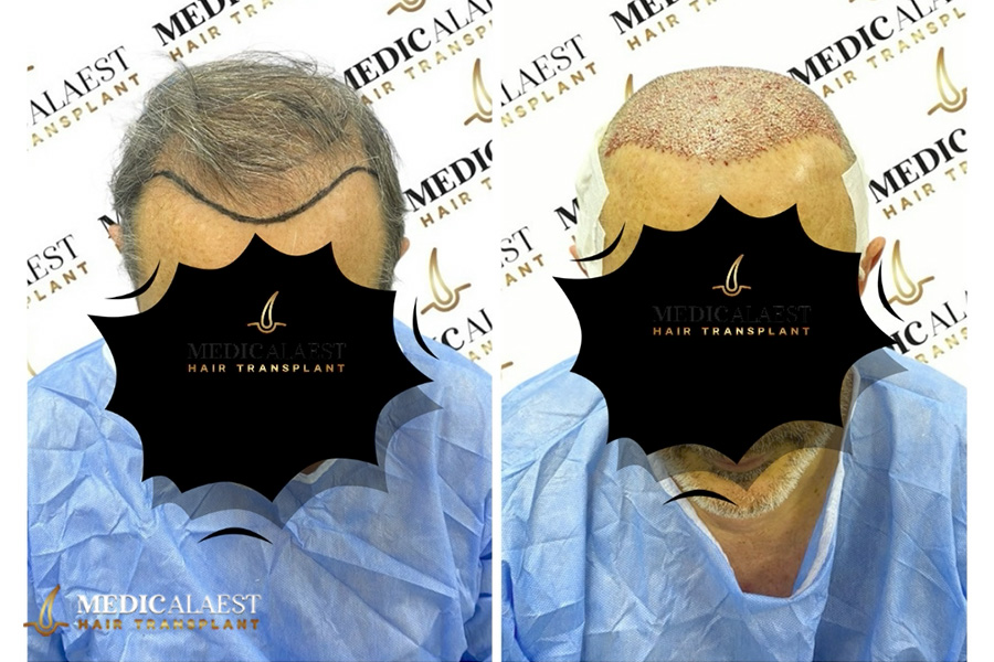 Medicalaest - BEFORE & AFTER GALLERY