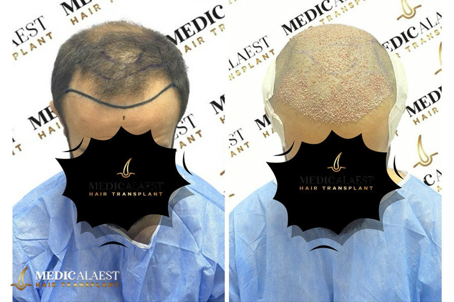 Medicalaest - BEFORE & AFTER GALLERY