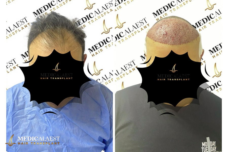 Medicalaest - BEFORE & AFTER GALLERY