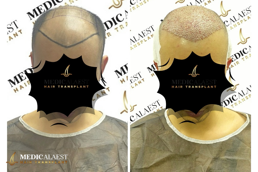 Medicalaest - BEFORE & AFTER GALLERY