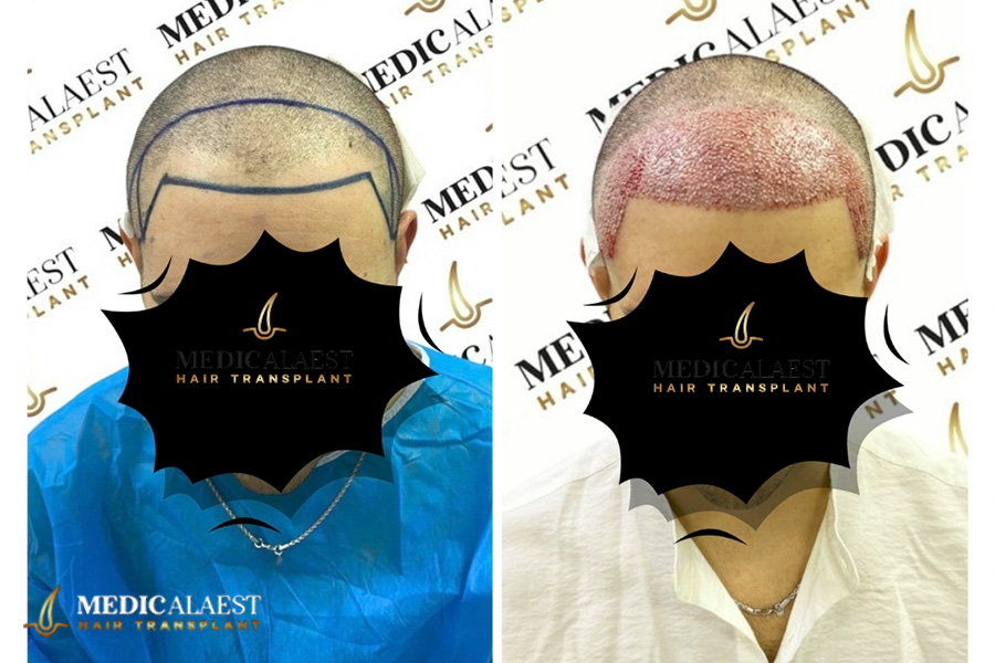 Medicalaest - BEFORE & AFTER GALLERY