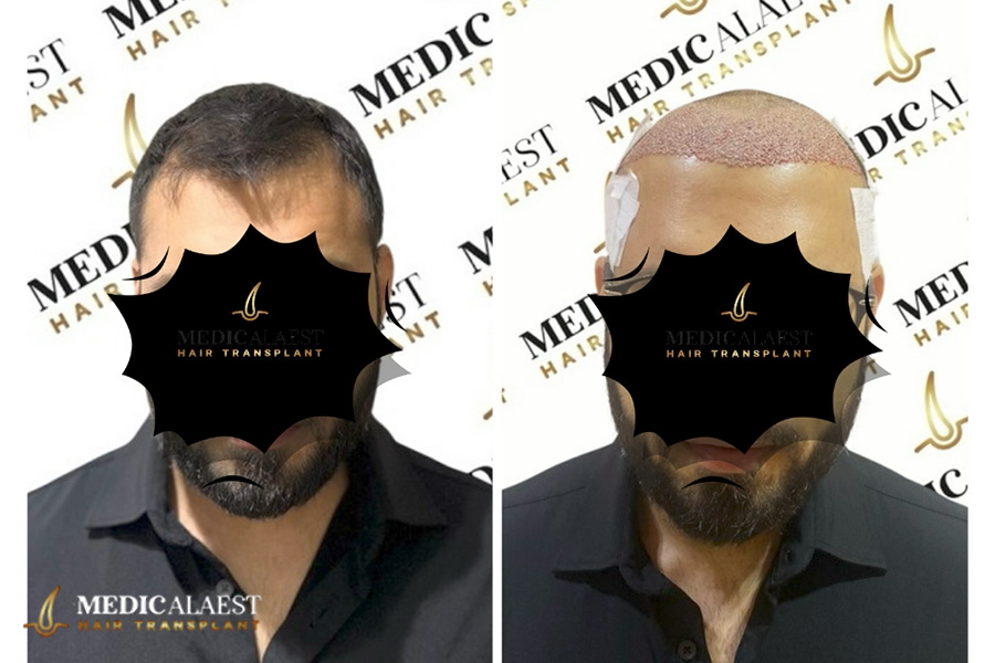 Medicalaest - BEFORE & AFTER GALLERY