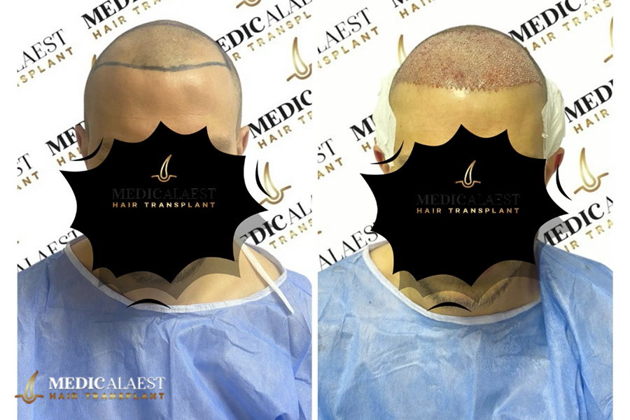 Medicalaest - BEFORE & AFTER GALLERY