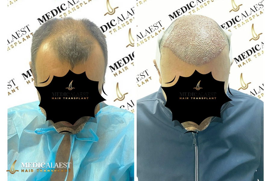 Medicalaest - BEFORE & AFTER GALLERY