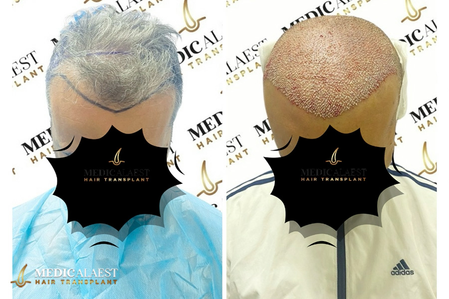 Medicalaest - BEFORE & AFTER GALLERY