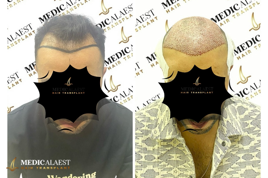 Medicalaest - BEFORE & AFTER GALLERY