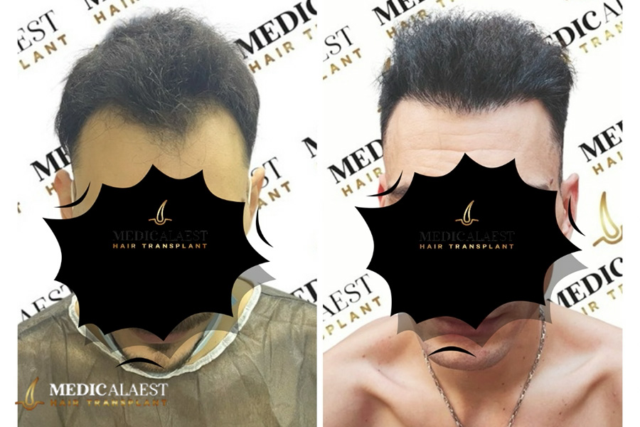 Medicalaest - BEFORE & AFTER GALLERY