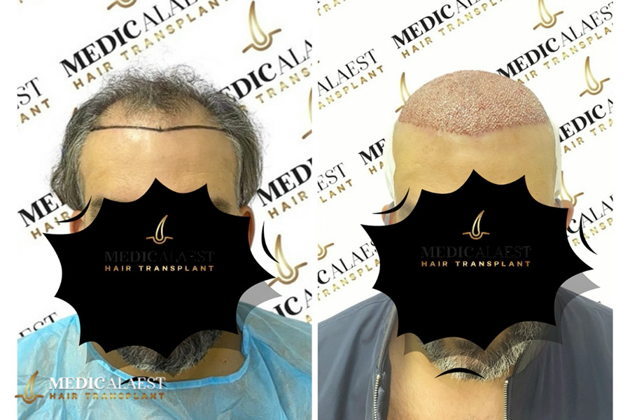 Medicalaest - BEFORE & AFTER GALLERY