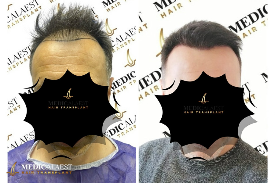 Medicalaest - BEFORE & AFTER GALLERY