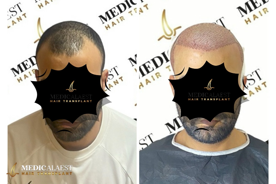 Medicalaest - BEFORE & AFTER GALLERY