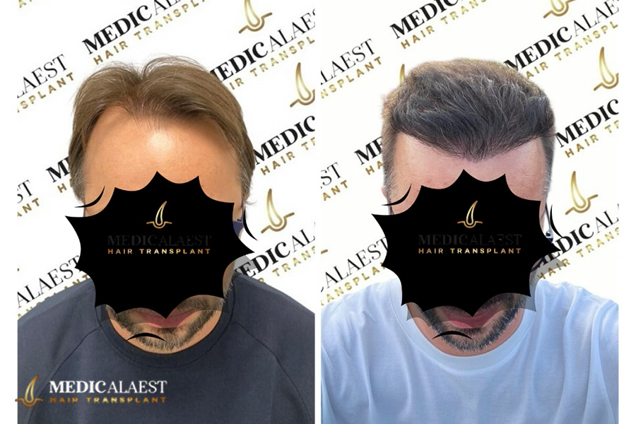 Medicalaest - BEFORE & AFTER GALLERY