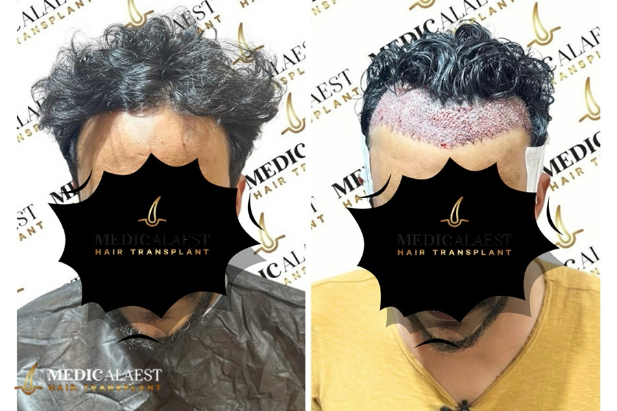 Medicalaest - BEFORE & AFTER GALLERY