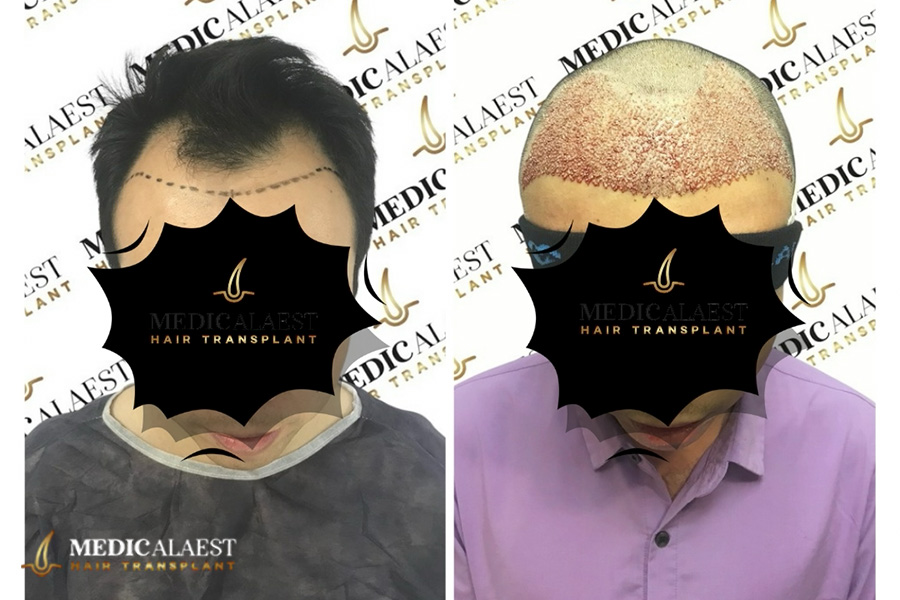 Medicalaest - BEFORE & AFTER GALLERY