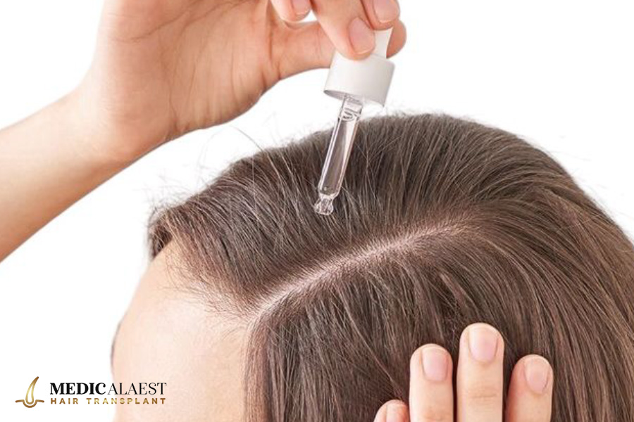 Medicalaest - PRP THERAPY FOR HAIR LOSS