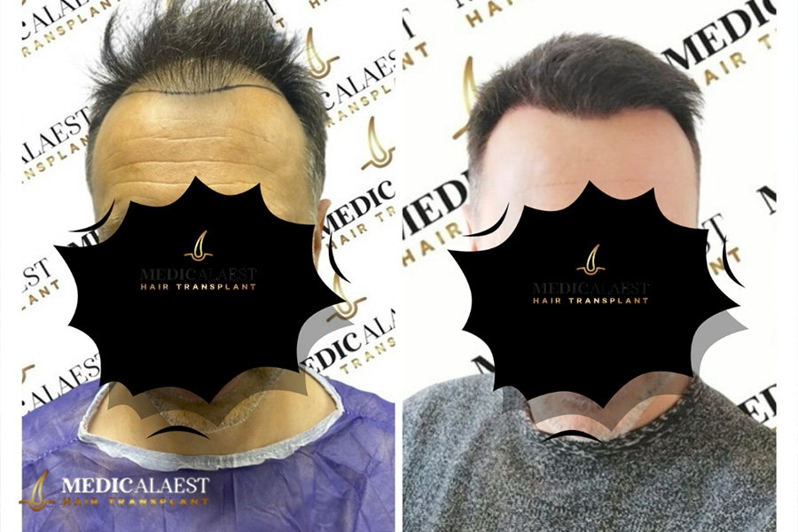 Medicalaest - RESULTS